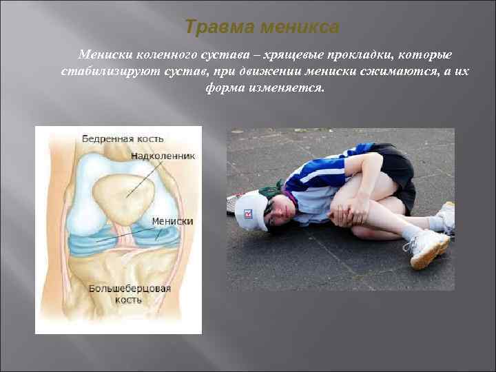 Травма меникса Мениски коленного сустава – хрящевые прокладки, которые стабилизируют сустав, при движении мениски
