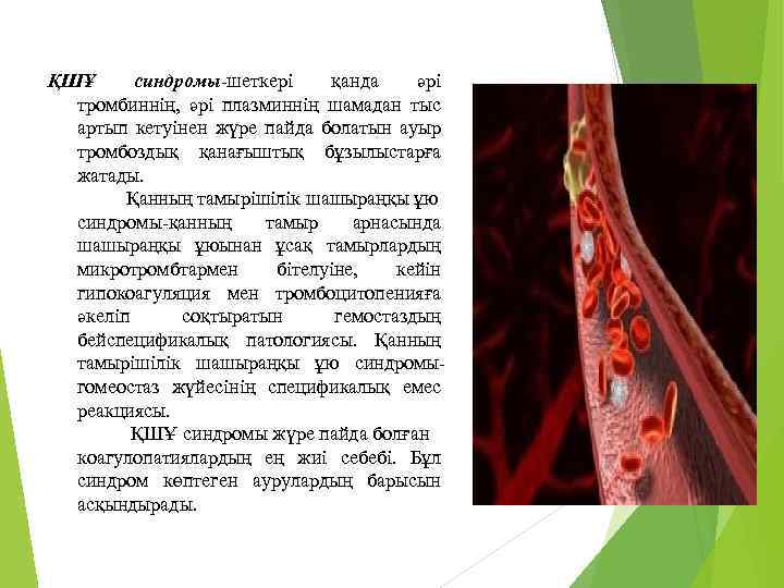 ҚШҰ синдромы-шеткері қанда әрі тромбиннің, әрі плазминнің шамадан тыс артып кетуінен жүре пайда болатын
