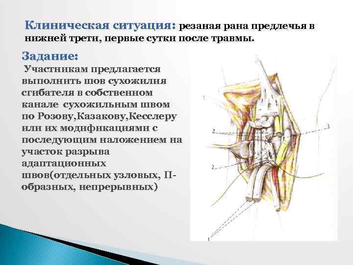 Клиническая ситуация: резаная рана предлечья в нижней трети, первые сутки после травмы. Задание: Участникам