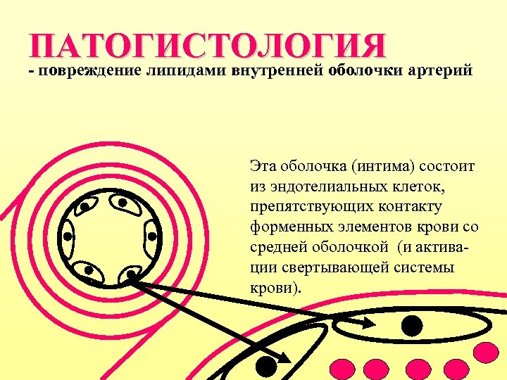 ПАТОГИСТОЛОГИЯ - повреждение липидами внутренней оболочки артерий Эта оболочка (интима) состоит из эндотелиальных клеток,