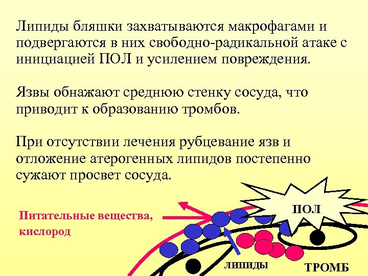 Липиды бляшки захватываются макрофагами и подвергаются в них свободно-радикальной атаке с инициацией ПОЛ и