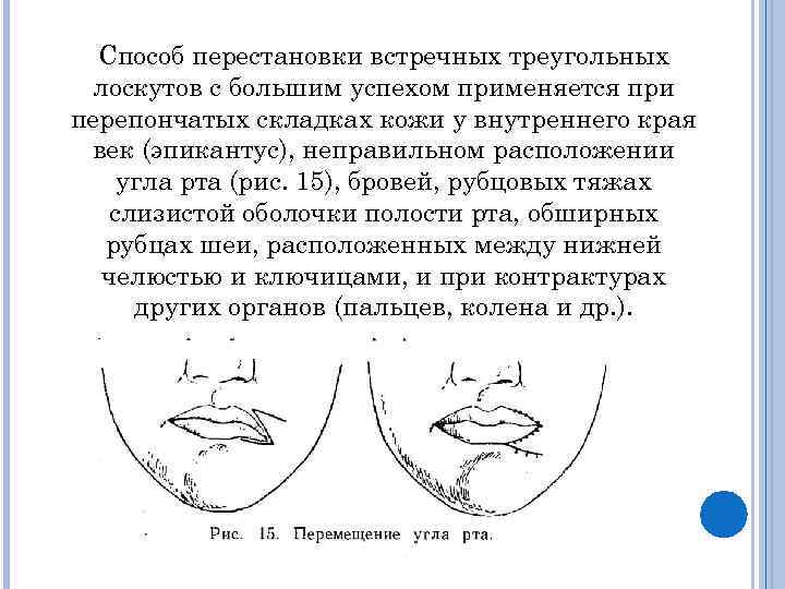 При отборе образцов запаха у подозреваемого лоскуты байки помещают раздельно в развернутом виде