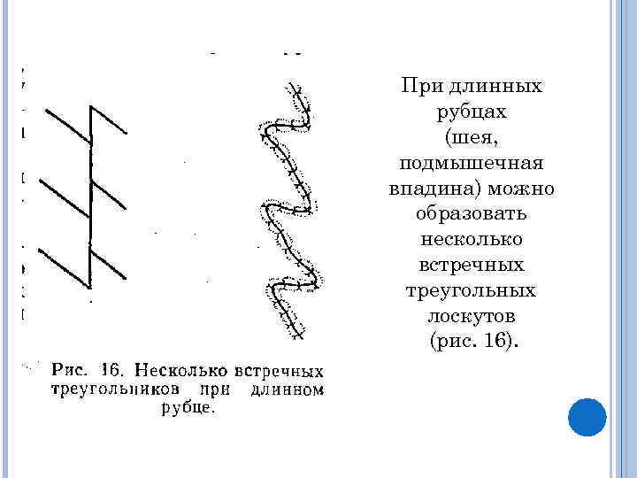 При длинных рубцах (шея, подмышечная впадина) можно образовать несколько встречных треугольных лоскутов (рис. 16).