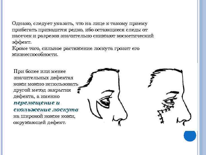 Однако, следует указать, что на лице к такому приему прибегать приходится редко, ибо остающиеся
