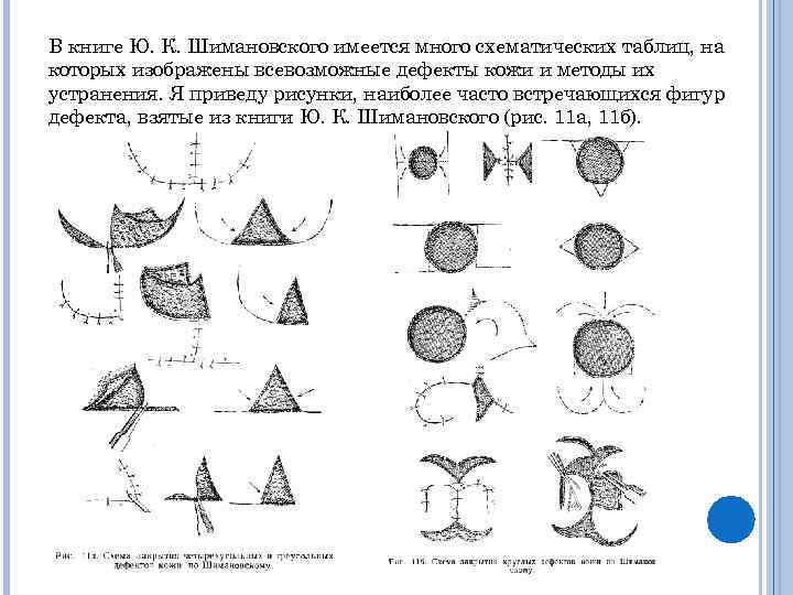 На рисунке 379 изображены в разрезе линзы различной формы