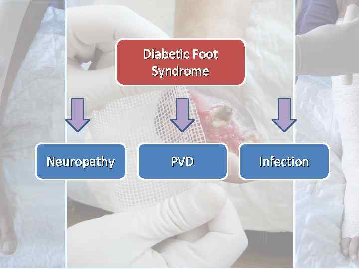 Diabetic Foot Syndrome Neuropathy PVD Infection 