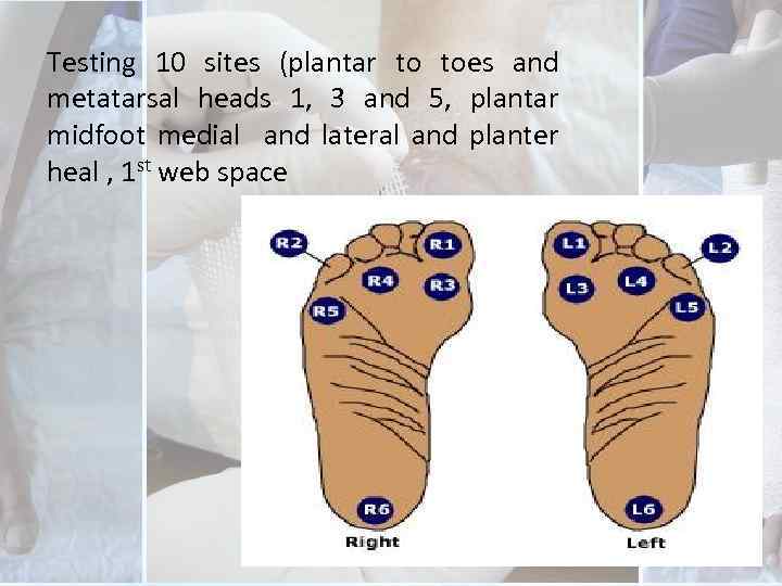 Testing 10 sites (plantar to toes and metatarsal heads 1, 3 and 5, plantar