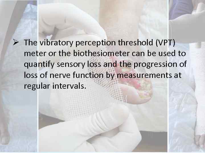 Ø The vibratory perception threshold (VPT) meter or the biothesiometer can be used to