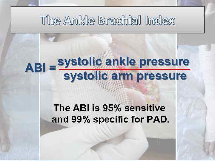 The Ankle Brachial Index systolic ankle pressure ABI = systolic arm pressure The ABI