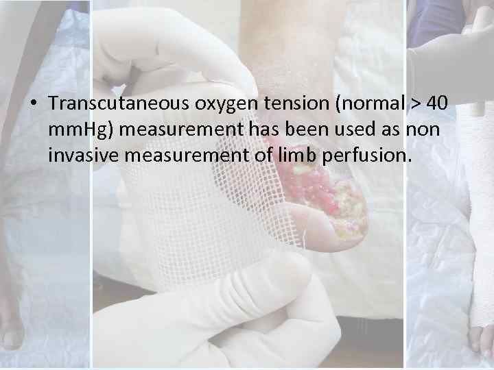  • Transcutaneous oxygen tension (normal > 40 mm. Hg) measurement has been used