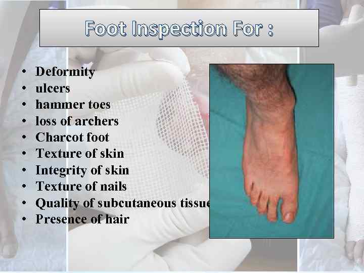 Foot Inspection For : • • • Deformity ulcers hammer toes loss of archers