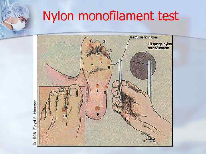 Nylon monofilament test 