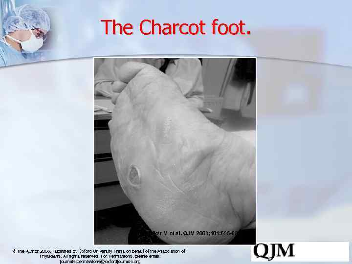 The Charcot foot. Khanolkar M et al. QJM 2008; 101: 685 -695 © The