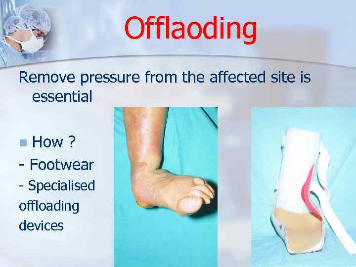 Offlaoding Remove pressure from the affected site is essential How ? - Footwear n