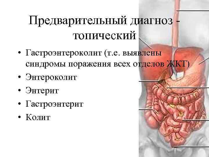 Предварительный диагноз топический • Гастроэнтероколит (т. е. выявлены синдромы поражения всех отделов ЖКТ) •