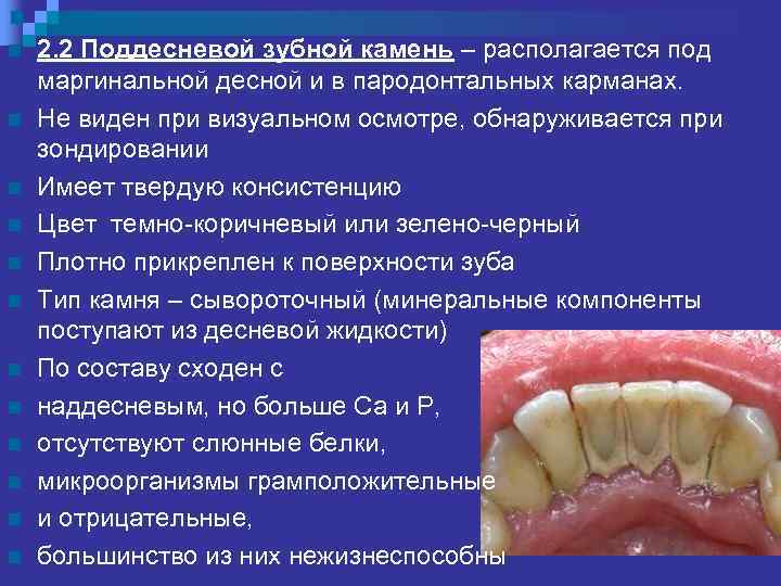 n n n 2. 2 Поддесневой зубной камень – располагается под маргинальной десной и