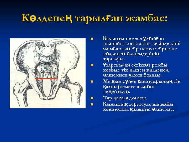 Көлденең тарылған жамбас: n n n Қалыпты немесе ұлғайған шынайы конъюгата кезінде кіші жамбастың