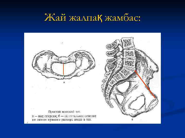 Жай жалпақ жамбас: 