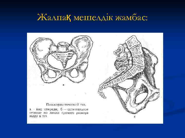 Жалпақ мешелдік жамбас: 