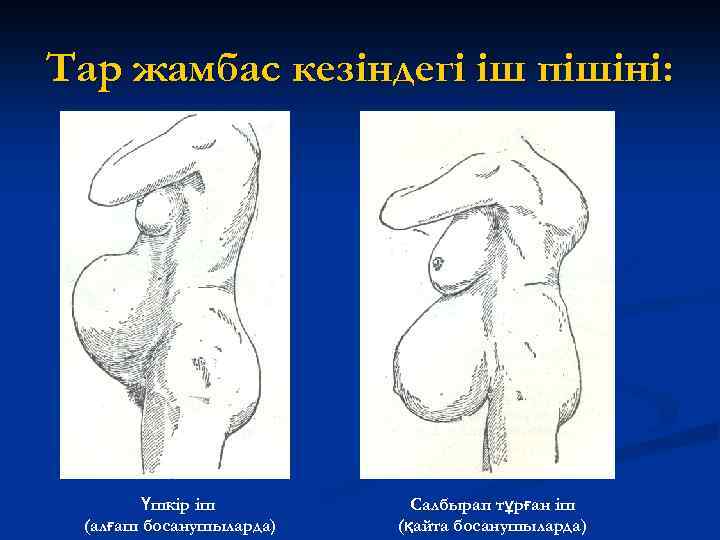 Тар жамбас кезіндегі іш пішіні: Үшкір іш (алғаш босанушыларда) Салбырап тұрған іш (қайта босанушыларда)