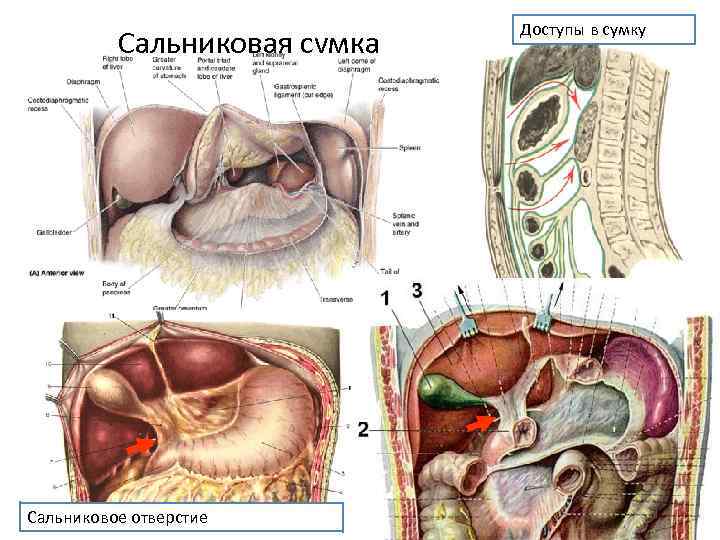 Сальниковая сумка Сальниковое отверстие Доступы в сумку 