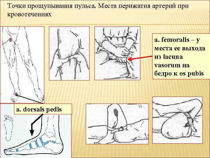 Точки прощупывания пульса. Места перижатия артерий при кровотечениях a. femoralis – у места ее