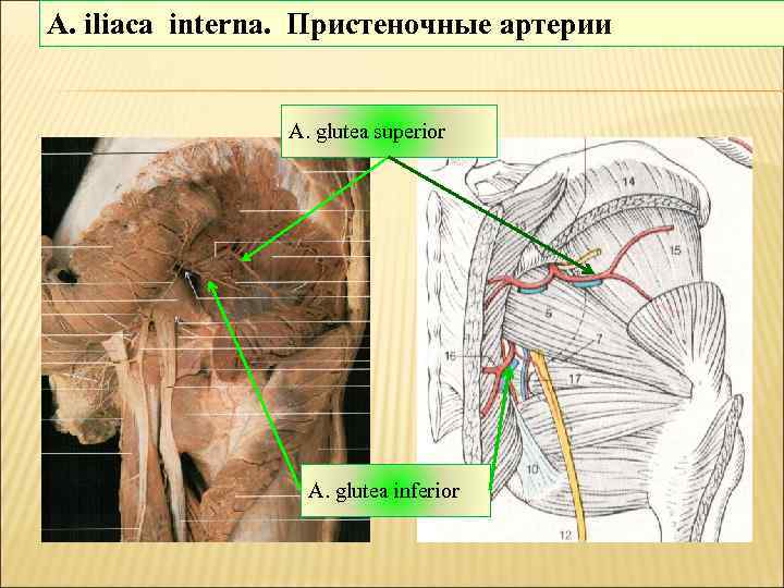 A. iliaca interna. Пристеночные артерии A. glutea superior A. glutea inferior 
