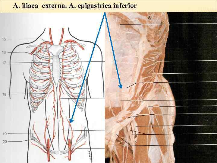 A. iliaca externa. А. epigastrica inferior 