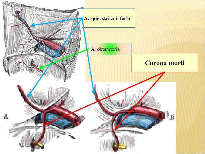 А. epigastrica inferior A. obturatoria Corona morti 