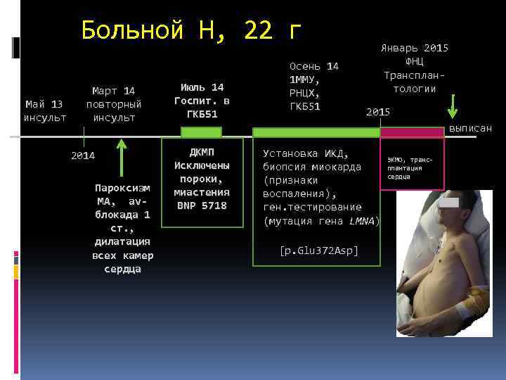 Больной Н, 22 г Май 13 инсульт Март 14 повторный инсульт 2014 Пароксизм МА,