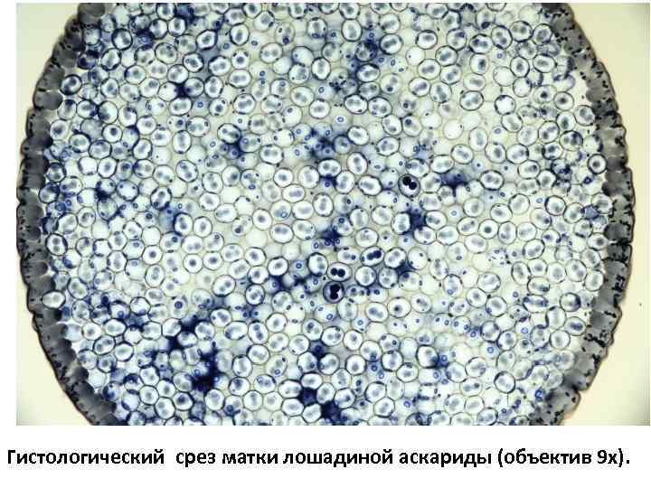 Гистологический срез матки лошадиной аскариды (объектив 9 х). 