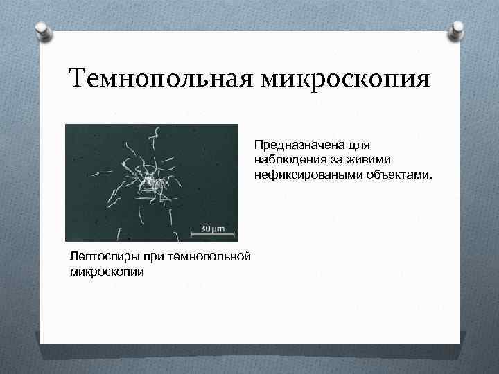 Темнопольная микроскопия Предназначена для наблюдения за живими нефиксироваными объектами. Лептоспиры при темнопольной микроскопии 