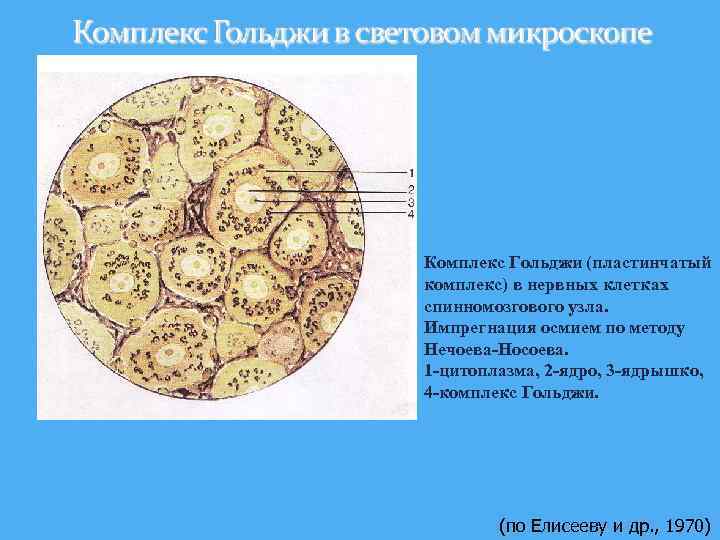 Комплекс Гольджи (пластинчатый комплекс) в нервных клетках спинномозгового узла. Импрегнация осмием по методу Нечоева-Носоева.