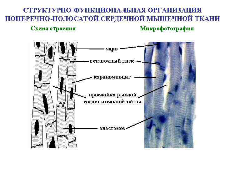 СТРУКТУРНО-ФУНКЦИОНАЛЬНАЯ ОРГАНИЗАЦИЯ ПОПЕРЕЧНО-ПОЛОСАТОЙ СЕРДЕЧНОЙ МЫШЕЧНОЙ ТКАНИ Схема строения Микрофотография ядро вставочный диск кардиомиоцит прослойка