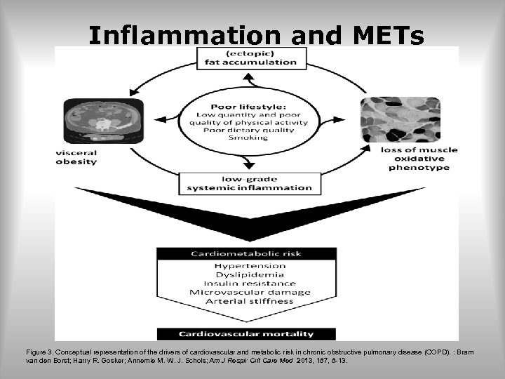 Inflammation and METs Figure 3. Conceptual representation of the drivers of cardiovascular and metabolic