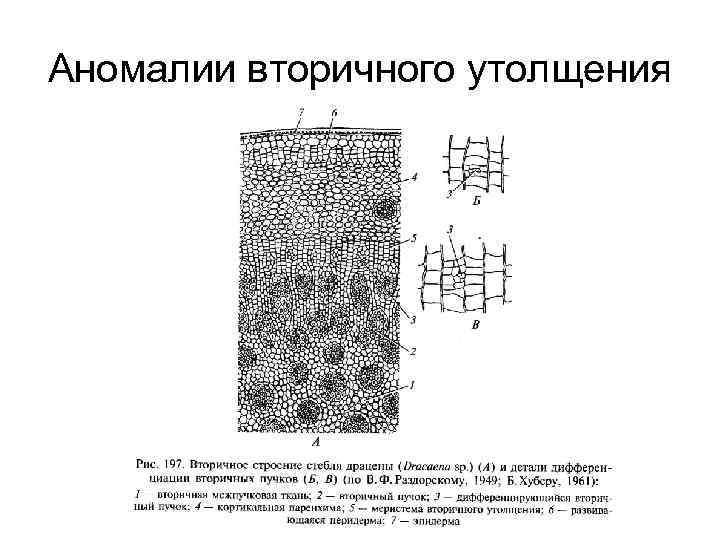 Аномалии вторичного утолщения 