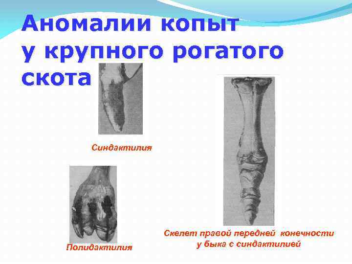 Аномалии копыт у крупного рогатого скота Синдактилия Полидактилия Скелет правой передней конечности у быка