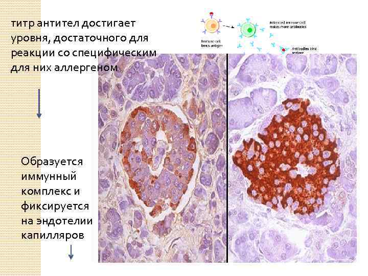 титр антител достигает уровня, достаточного для реакции со специфическим для них аллергеном Образуется иммунный