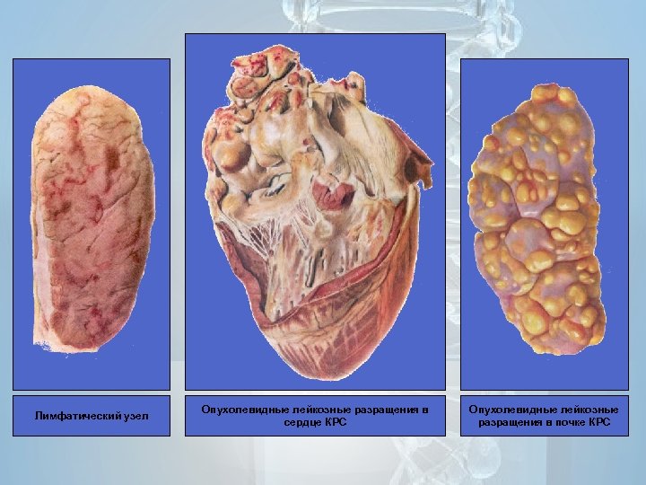Лимфатический узел Опухолевидные лейкозные разращения в сердце КРС Опухолевидные лейкозные разращения в почке КРС