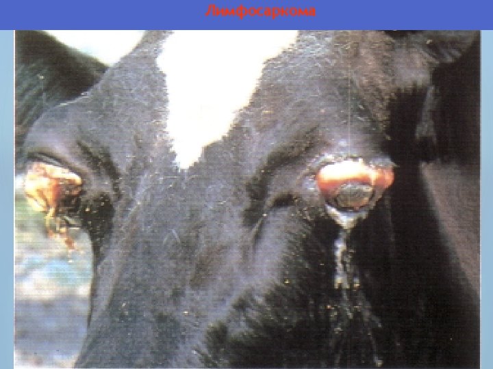 Лимфосаркома 