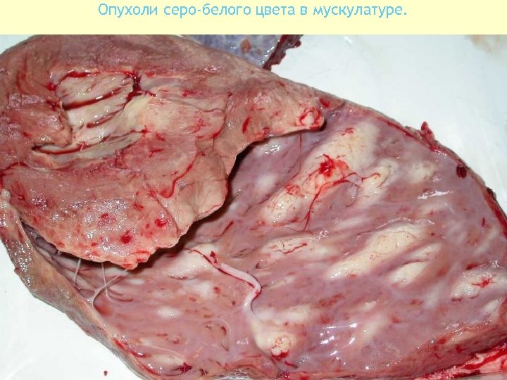 Опухоли серо-белого цвета в мускулатуре. 