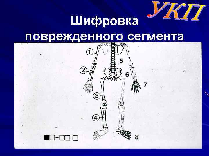 Шифровка поврежденного сегмента 