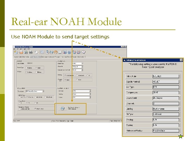 Real-ear NOAH Module Use NOAH Module to send target settings 