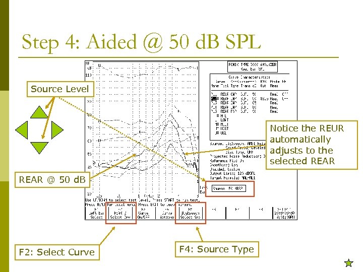 Step 4: Aided @ 50 d. B SPL Source Level Notice the REUR automatically