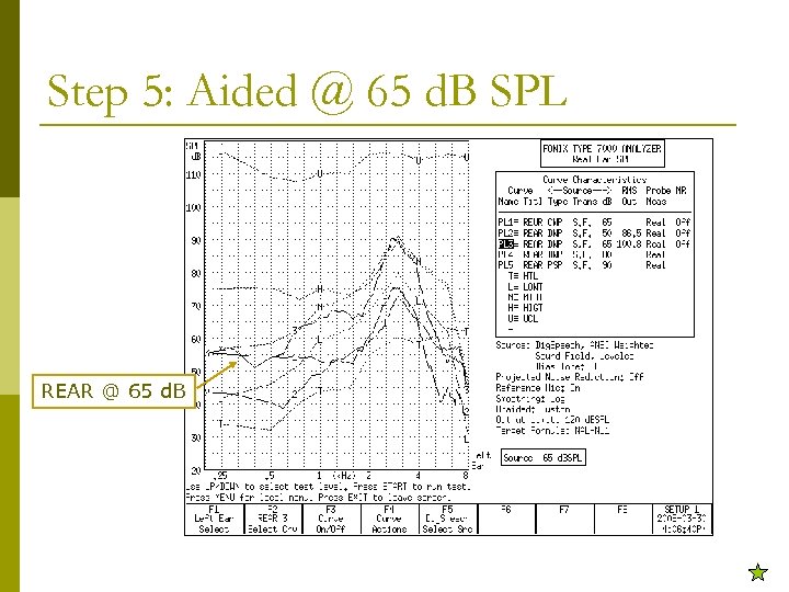 Step 5: Aided @ 65 d. B SPL REAR @ 65 d. B 