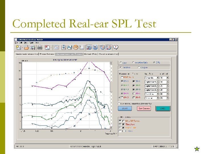 Completed Real-ear SPL Test 