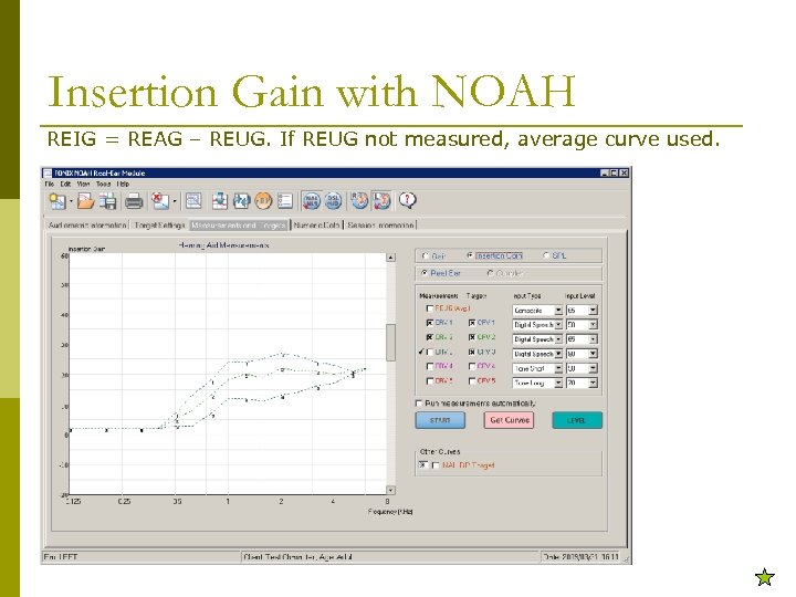Insertion Gain with NOAH REIG = REAG – REUG. If REUG not measured, average