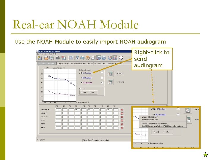 Real-ear NOAH Module Use the NOAH Module to easily import NOAH audiogram Right-click to