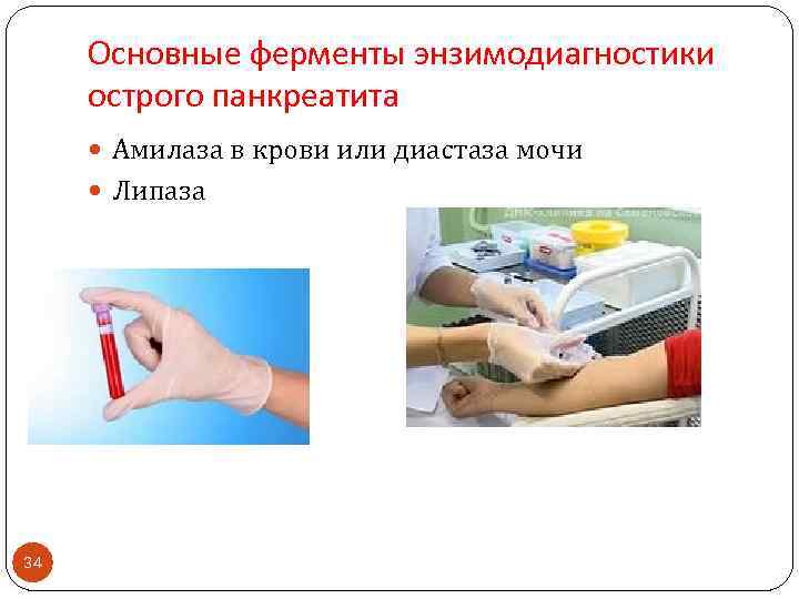 Основные ферменты энзимодиагностики острого панкреатита Амилаза в крови или диастаза мочи Липаза 34 
