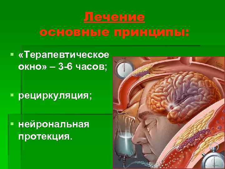 Лечение основные принципы: § «Терапевтическое окно» – 3 -6 часов; § рециркуляция; § нейрональная